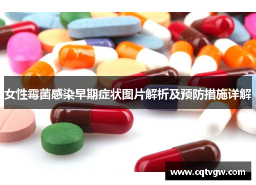 女性霉菌感染早期症状图片解析及预防措施详解